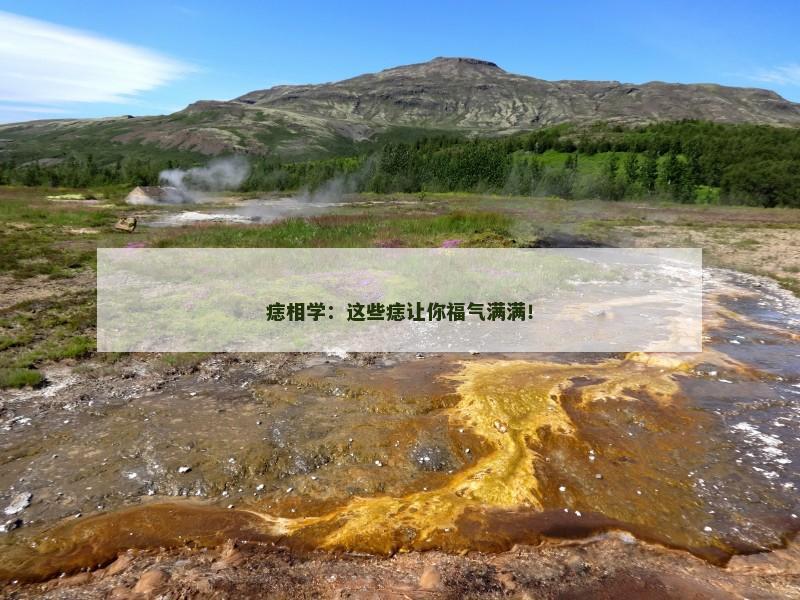 痣相学：这些痣让你福气满满！